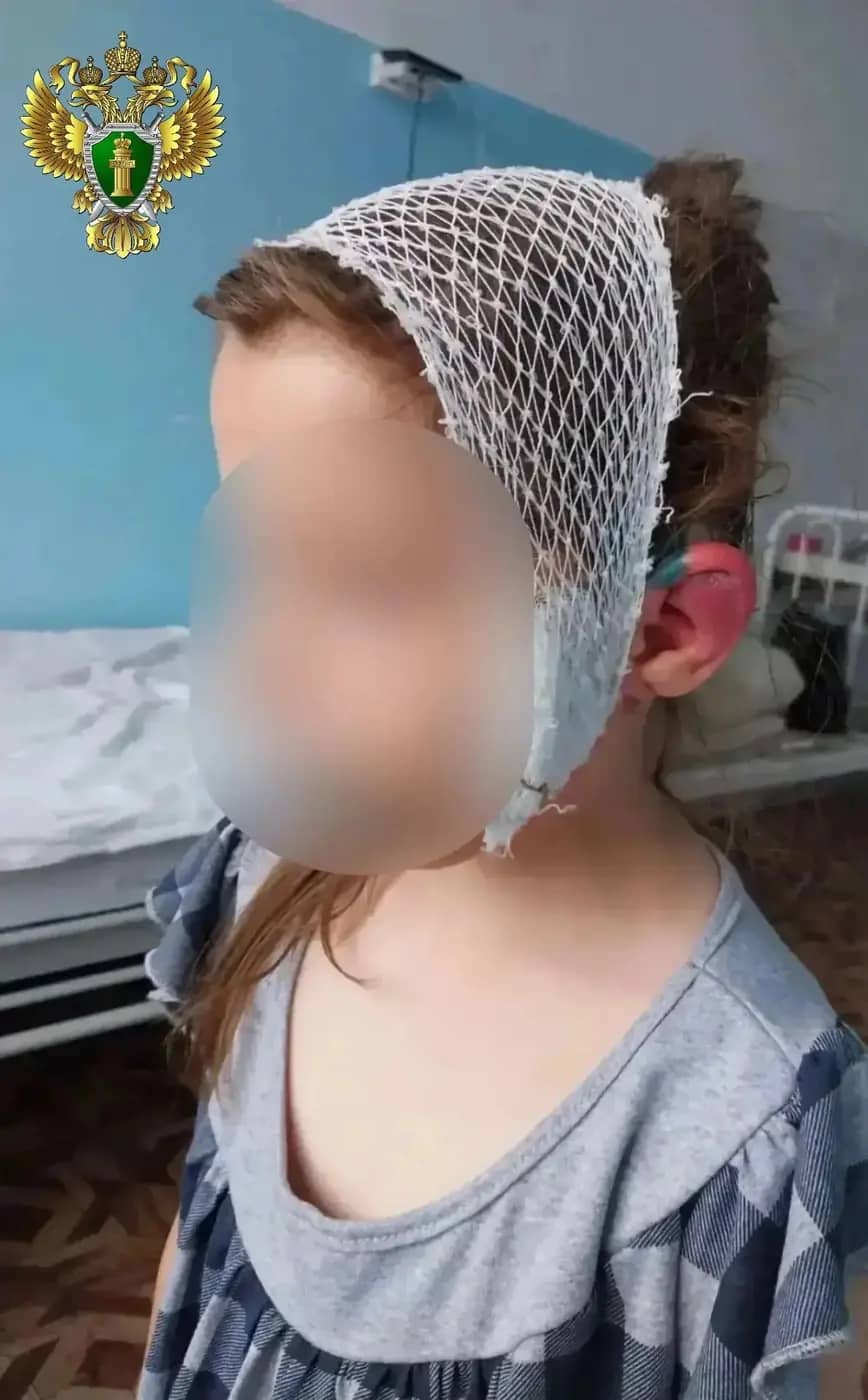Суд взыскал 250 тыс. рублей за нападение собаки на девочку в Магнитогорске